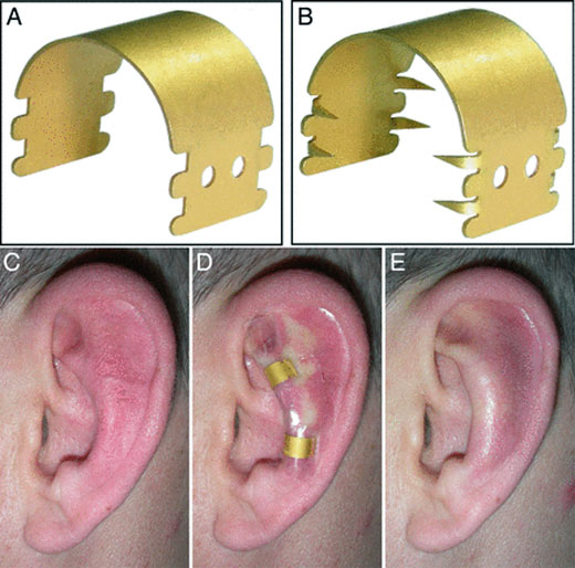 EARFOLD