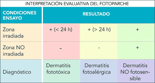 Fotosensibilidad