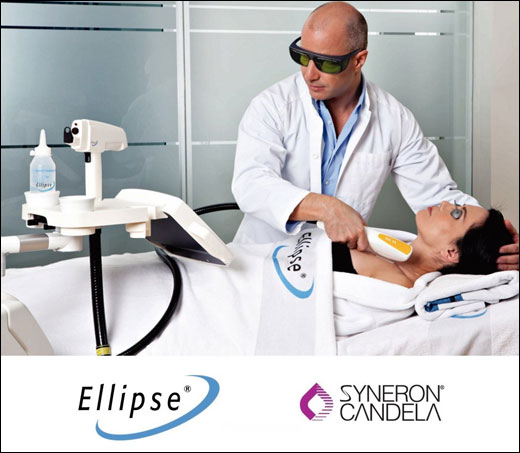 Syneron Candela Ellipse